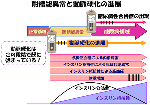 耐糖能異常と動脈硬化の進展