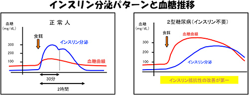 インスリン分泌パターンと血糖推移