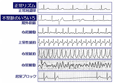 心臓のリズム